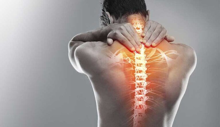 Stiprus skausmas vidurinėje nugaros dalyje – stuburo pažeidimo požymis