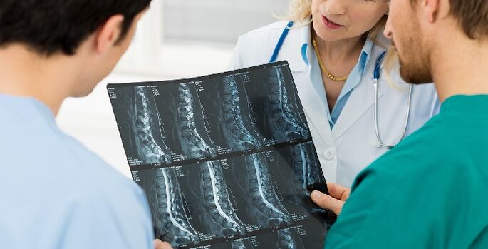 Stuburo rentgeno nuotrauka kaip būdas diagnozuoti osteochondrozę