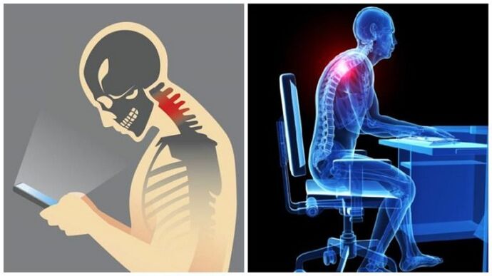 sėdimas darbas ir pasilenkimas kaip osteochondrozės vystymosi priežastys