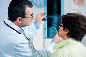 Gimdos kaklelio osteochondrozės rentgeno diagnostika